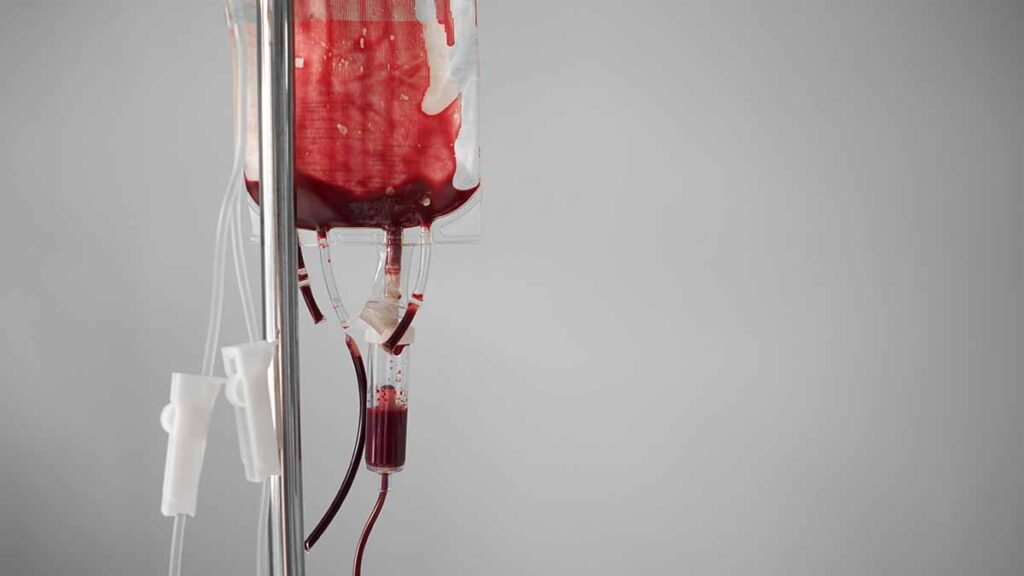 มีภาวะเลือดจางจำเป็นต้องให้เลือดไหม