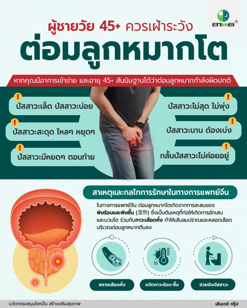 ปัสสาวะบ่อย ปัสสาวะไม่พุ่ง อาการต่อมลูกหมากโตที่ชายวัย 45+ ต้องรู้