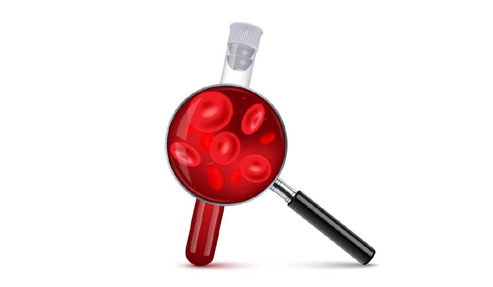 อาการโลหิตจาง ภาวะซีด สาเหตุ อาการ วิธีแก้