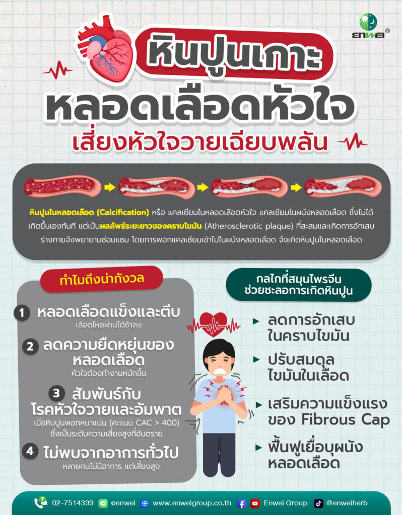 หินปูนในหลอดเลือด ความเสี่ยงที่ซ่อนอยู่และการดูแลด้วยสมุนไพรจีน
