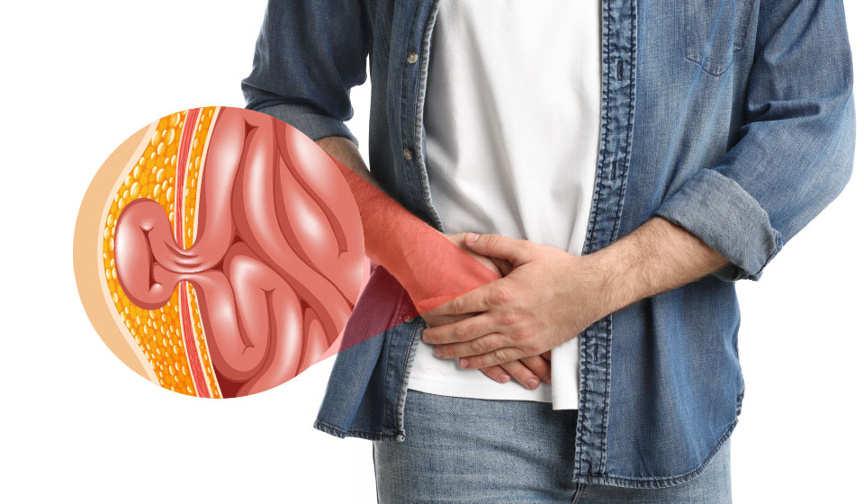 ม้ามอ่อนแอเกี่ยวข้องกับไส้เลื่อนหรือไม่