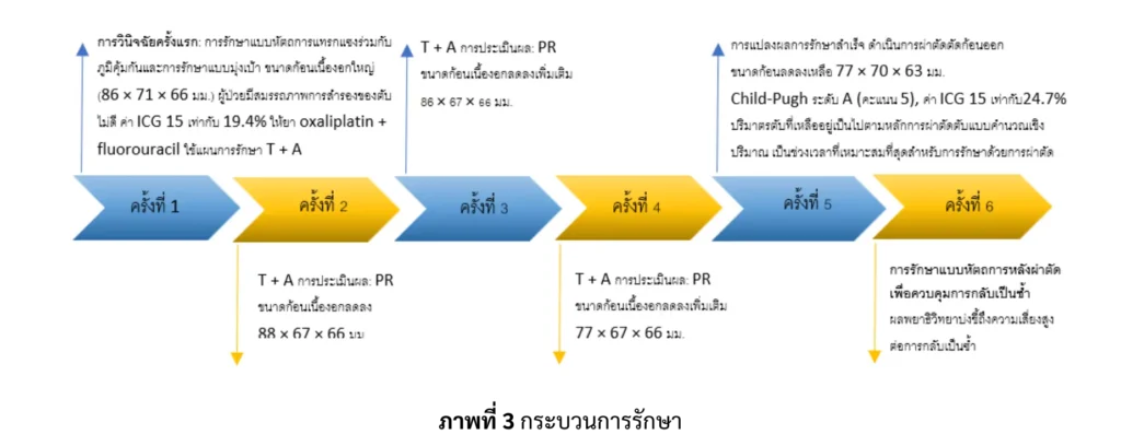กระบวนการรักษา ผู้ป่วยมะเร็งตับ