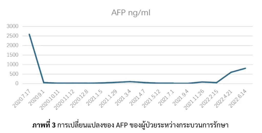 ผลตรวจ AFP มะเร็งตับ