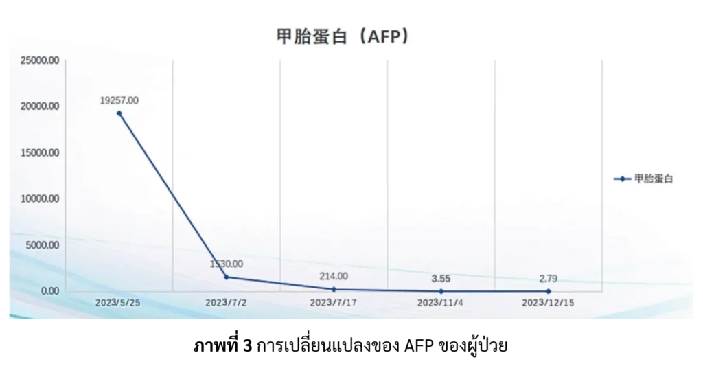 การเปลี่ยนแปลง AFP ของผู้ป่วยมะเร็งตับ