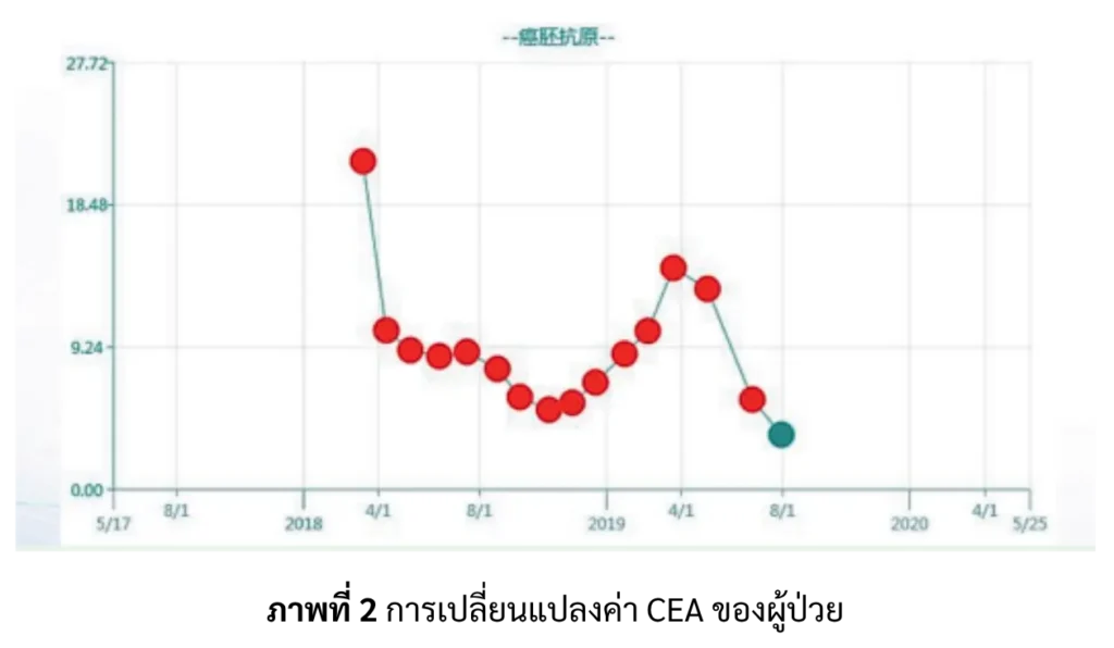 การเปลี่ยนแปลงค่า CEA ผู้ป่วยมะเร็งปอด