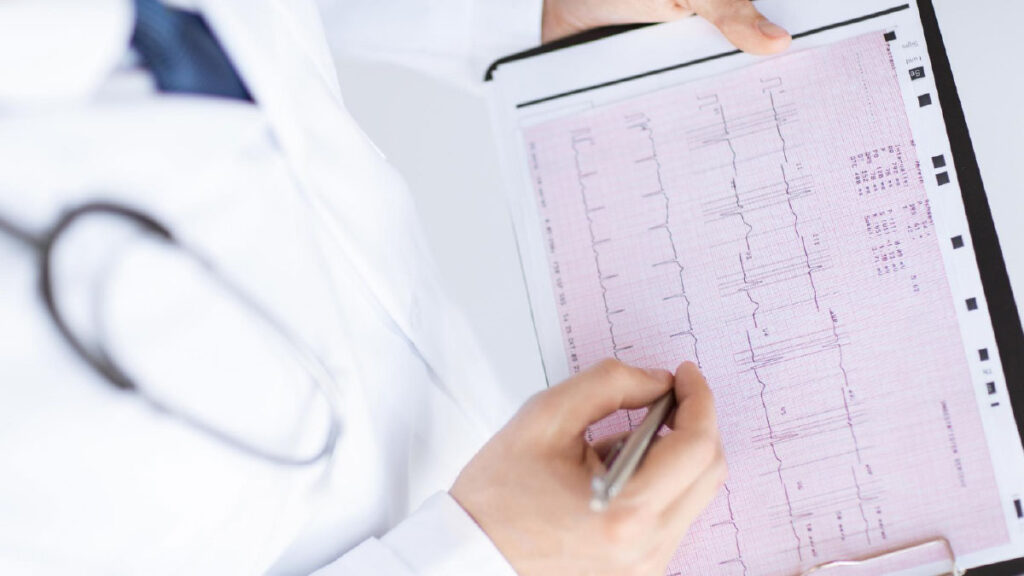 ตรวจคลื่นไฟฟ้าหัวใจ ECG บอกหลอดเลือดหัวใจตีบได้ไหม?