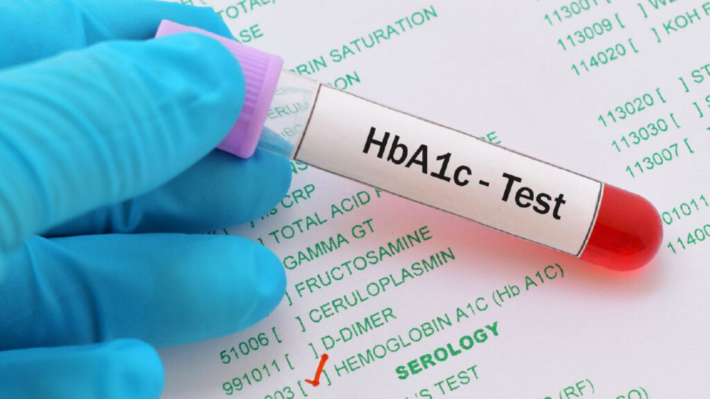 HbA1c คืออะไร? ค่าเท่าไรจึงปกติ และควรตรวจบ่อยแค่ไหน