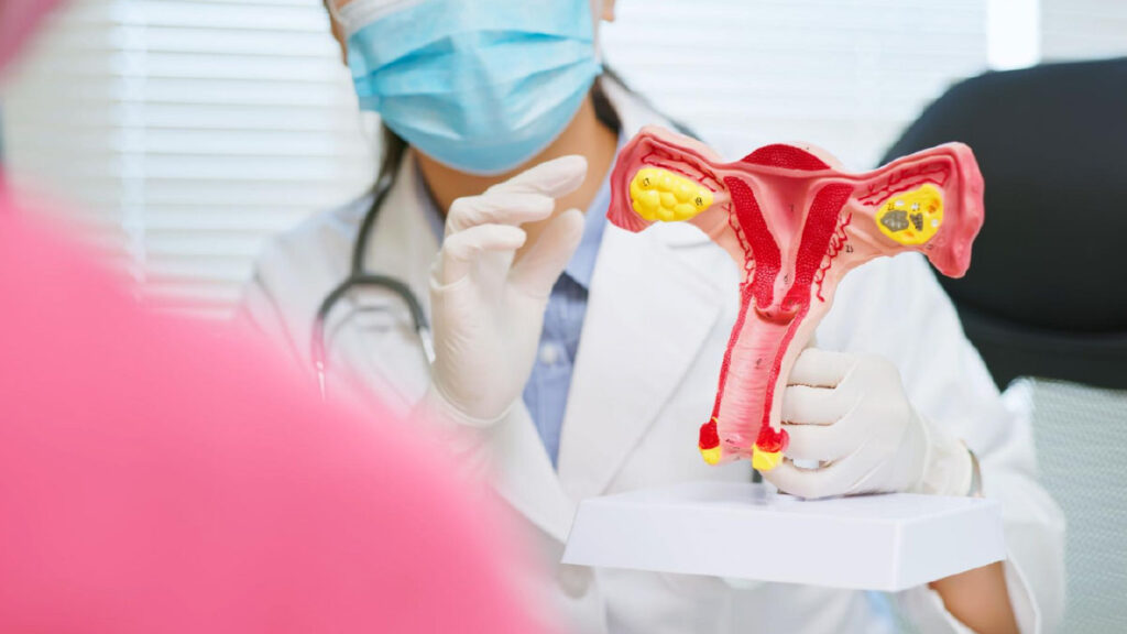 ตรวจ PCOS อย่างไร? ขั้นตอนวินิจฉัยและผลตรวจที่ควรรู้