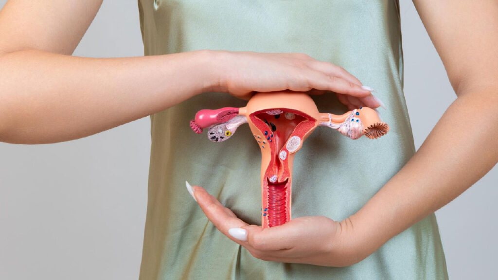 PCOS เกิดจากอะไร? รู้จักปัจจัยเสี่ยงที่เพิ่มโอกาสเกิดภาวะถุงน้ำรังไข่หลายใบ