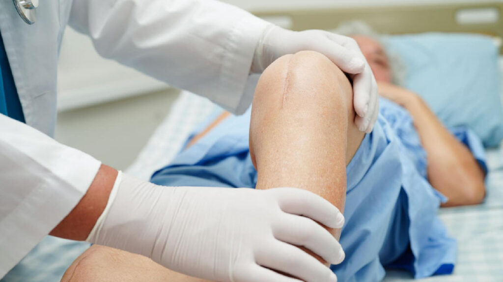 เข่าเสื่อมผ่าตัดเมื่อไร? 6 สัญญาณที่ควรประเมินเปลี่ยนข้อเข่า