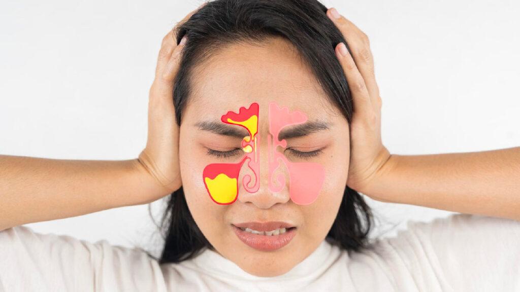 ไซนัสอักเสบคืออะไร? อาการ สาเหตุ การรักษา และวิธีป้องกัน