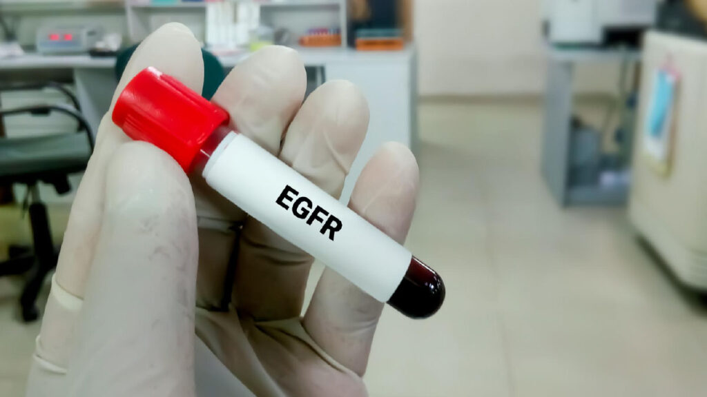 ค่า eGFR คืออะไร? ตัวเลขนี้บอกการทำงานของไตอย่างไร