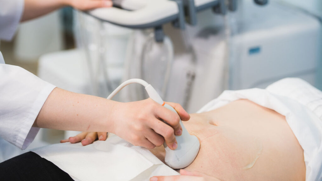 Chocolate Cyst ตรวจอย่างไร? Ultrasound บอกอะไรได้บ้าง