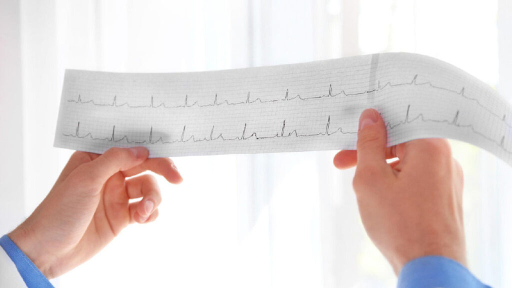 ใจสั่นต้องตรวจอะไร? ECG, Holter ช่วยหาสาเหตุอย่างไร